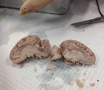 How does a fetal pig get rid of its waste products?